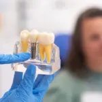 dentures vs implants